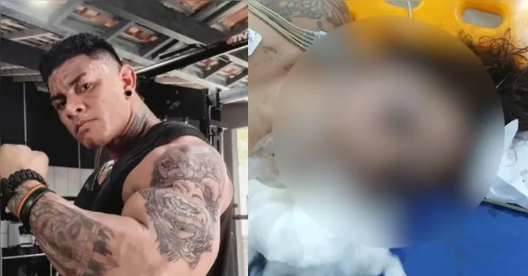 Morre mulher agredida pelo companheiro em Tomé-Açu