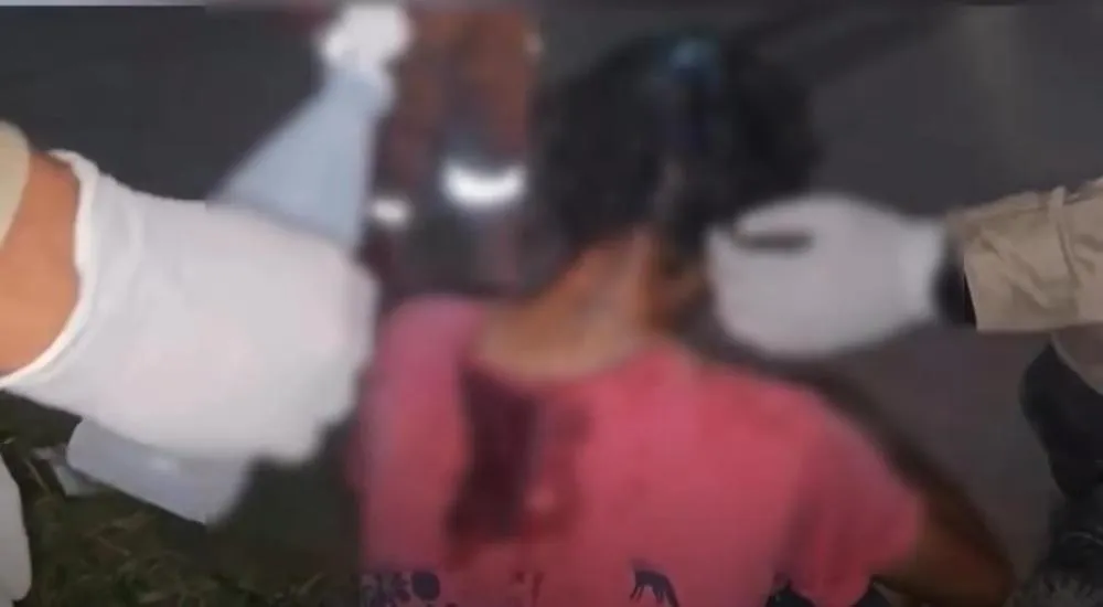 Jovem de 18 anos foi atingido na cabeça por um tijolo e precisou de atendimentos médico em Itaituba. ( Foto: Reprodução Redes Sociais )
